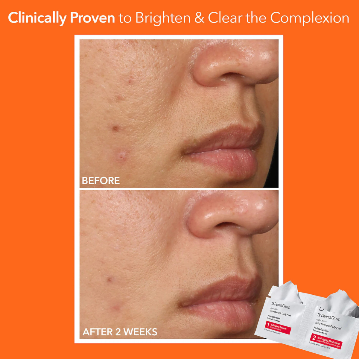 Skincare Alpha Beta Extra Strength Daily Peel (Pack of 30)