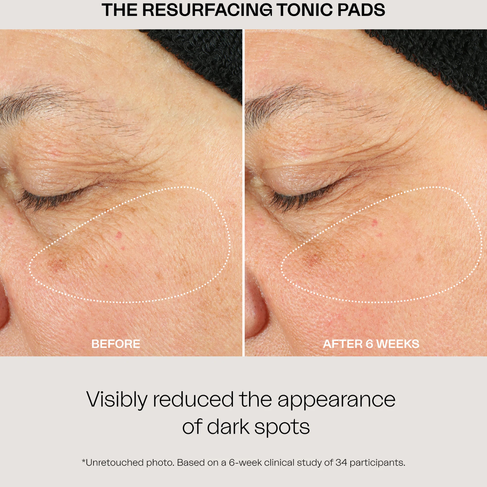 The Resurfacing Tonic Pads
