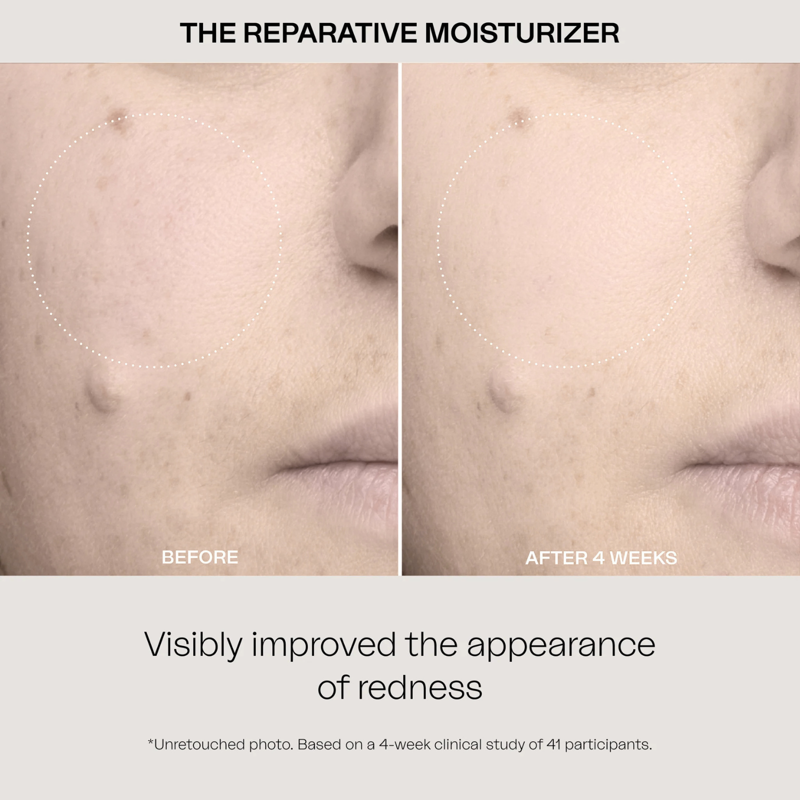 The Reparative Moisturizer