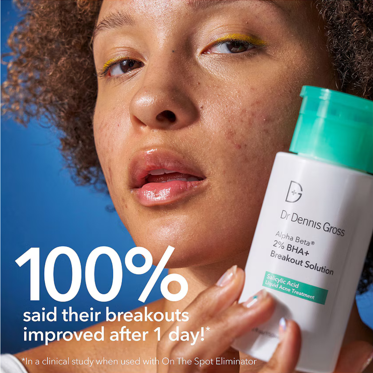 Alpha Beta® 2% BHA+ Breakout Solution