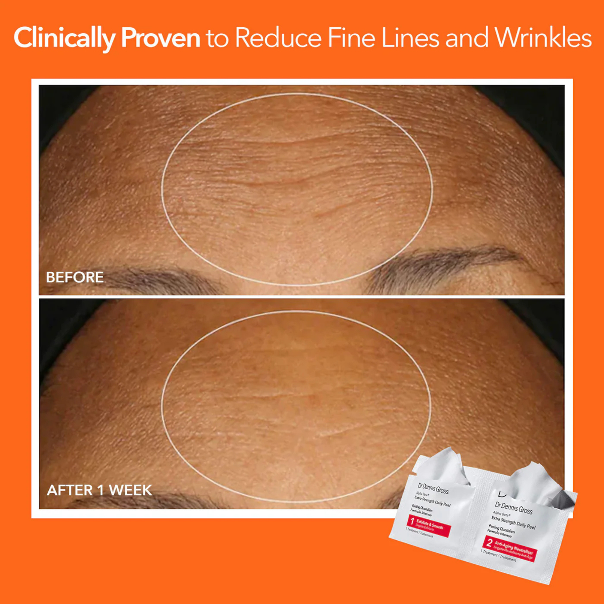 Skincare Alpha Beta Extra Strength Daily Peel (Pack of 30)