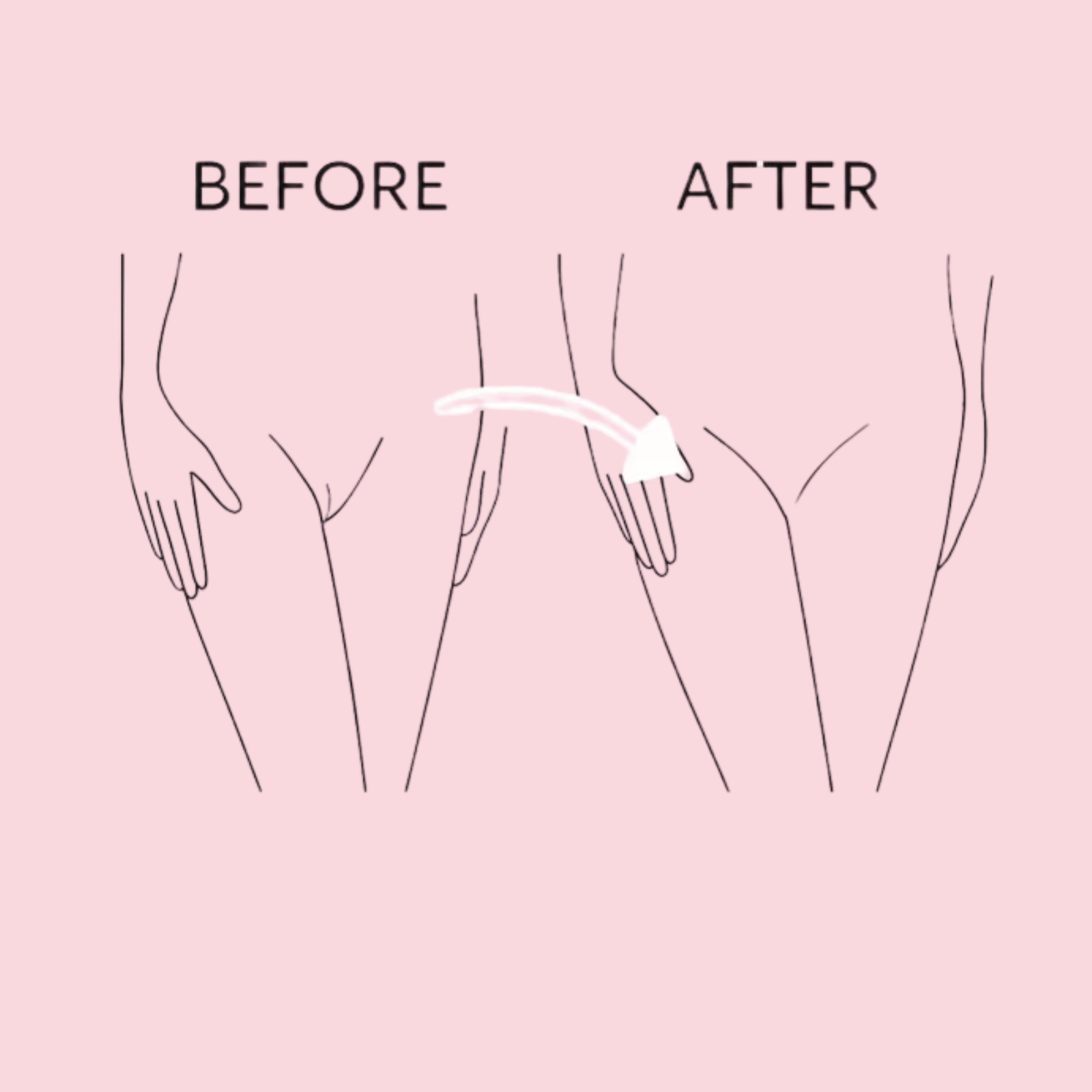 Camel Toe Concealer Patch | Seamless Silicone Coverage
